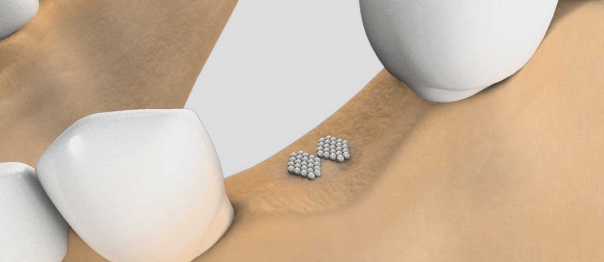 Restorative Dentistry Dental Works, Banning Dentist