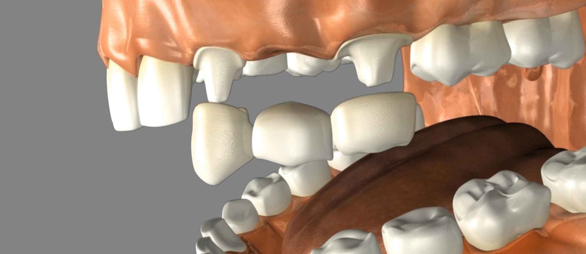 Restorative Dentistry Dental Works, Banning Dentist