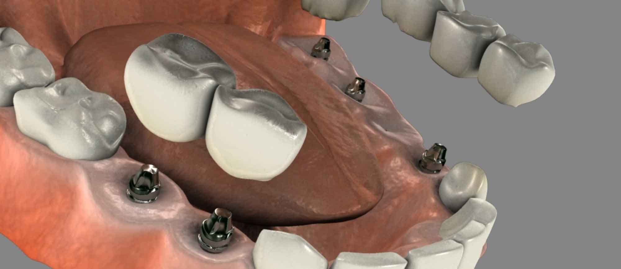 Dental Works Banning