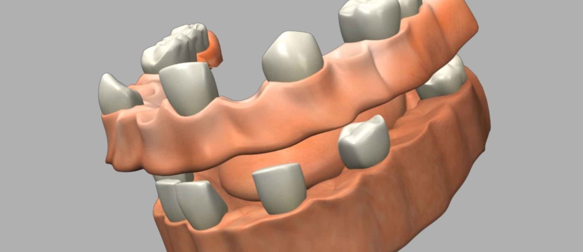Dental Works Banning