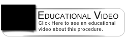 Dental Education Video - In-Office Whitening Procedure